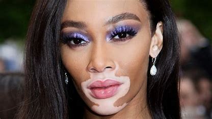 is-winnie-harlow-related-to-jack-harlow