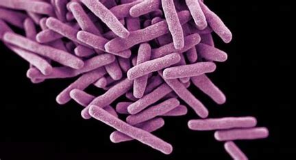 immunosuppression-in-aids-is-related-to